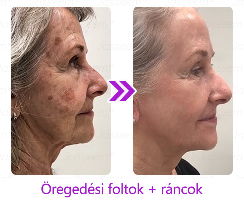đđđŹđŹđđđŠÂźâ
â
Fejlett, nem invazĂv bĆrjavĂtĂł COâ lĂ©zeres toll đ (GyengĂ©den eltĂĄvolĂtja a szemölcsöket, anyajegyeket, öregsĂ©gi foltokat Ă©s bĆrkinövĂ©seket â fĂĄjdalom Ă©s gond nĂ©lkĂŒl!)