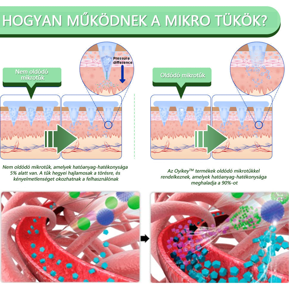 [Lásd az eredményeket 7 nap múlva]🌲0yikey™ SMGT-GLP-1 nano mikrotűs tapasz (Fájdalommentes, hosszan tartó, kezeli a cukorbetegséget, az elhízást és a szív- és érrendszeri betegségeket)