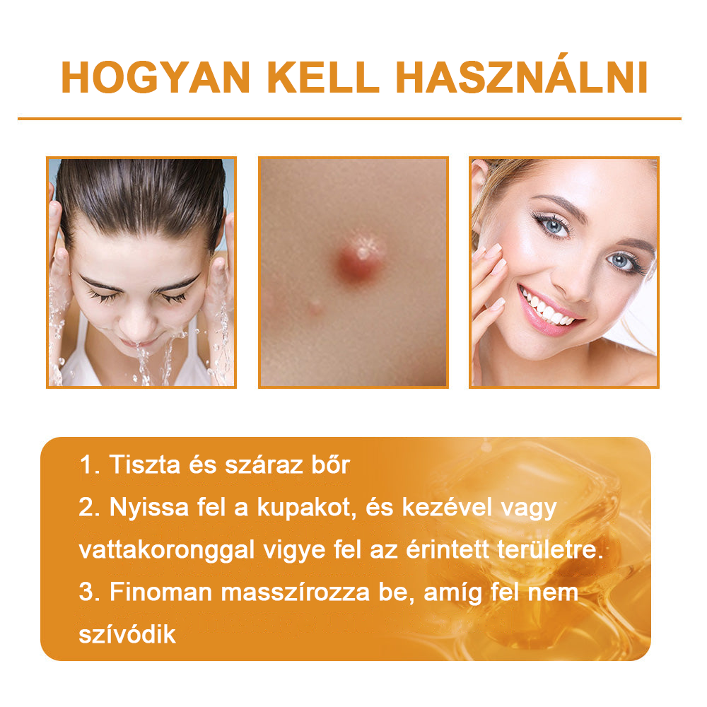 🏵️[Hivatalos zászlóshajó üzlet] 𝑻𝒖𝒓𝒐𝒏𝒖™ méhméreg bőrápoló krém (👨‍⚕𝐀𝐀𝐃 JAVASLATOK)