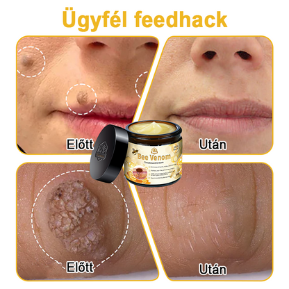 🏵️[Hivatalos zászlóshajó üzlet] 𝑻𝒖𝒓𝒐𝒏𝒖™ méhméreg bőrápoló krém (👨‍⚕𝐀𝐀𝐃 JAVASLATOK)