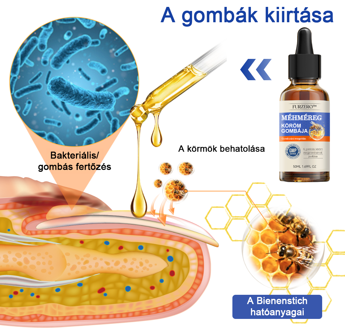 🌟🌟Furzero™ méhméreg körömgomba kezelési megoldás:Teljesen megoldja a körömgomba problémát🐝🐝