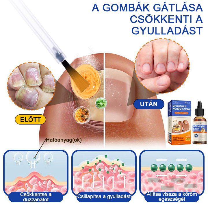 🌟🌟Furzero™ méhméreg körömgomba kezelési megoldás:Teljesen megoldja a körömgomba problémát🐝🐝