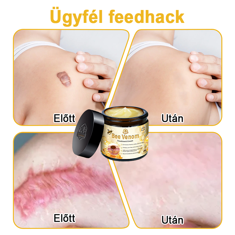 🏵️[Hivatalos zászlóshajó üzlet] 𝑻𝒖𝒓𝒐𝒏𝒖™ méhméreg bőrápoló krém (👨‍⚕𝐀𝐀𝐃 JAVASLATOK)