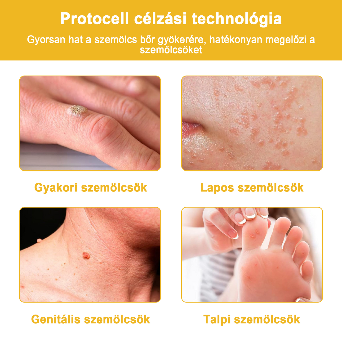 🏵️[Hivatalos zászlóshajó üzlet] 𝑻𝒖𝒓𝒐𝒏𝒖™ méhméreg bőrápoló krém (👨‍⚕𝐀𝐀𝐃 JAVASLATOK)